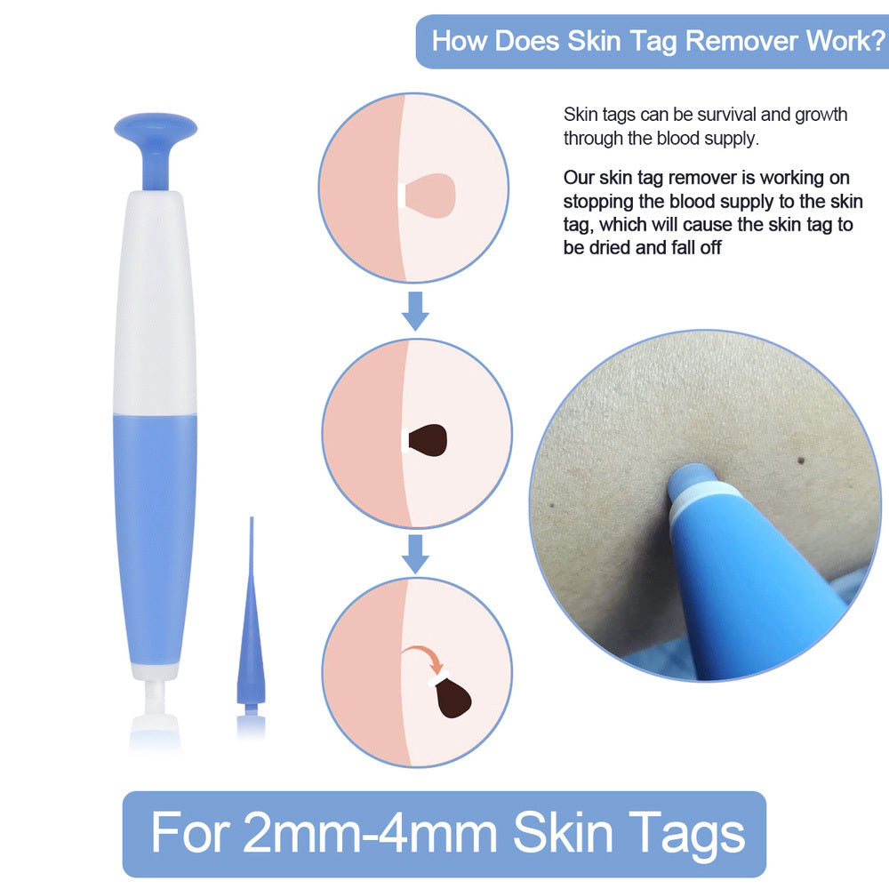 Skin Tag Removal Kit Home Use Mole Wart Remover Micro Band | Skin Tag Treatment Tool Easy To Clean Skin Care Tool